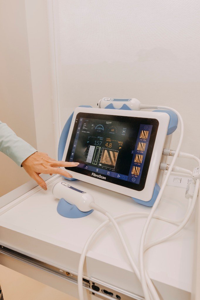 Equipamento FibroScan para elastografia hepática na Clínica Personne